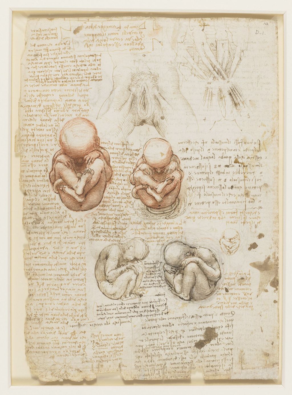 The fetus and muscles attached to the pelvis.